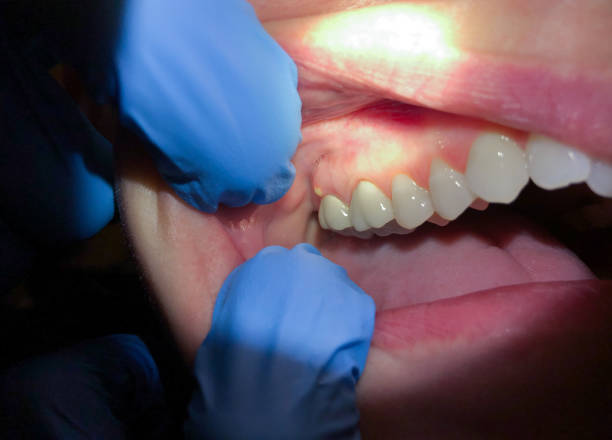Best Broken or Chipped Tooth Repair in Mante, CA