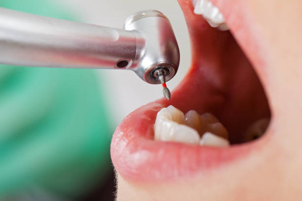 Best Emergency Care for Gum Disease in Mante, CA